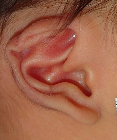 生後3日目の耳の形。