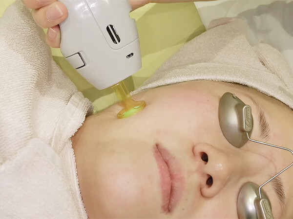 レーザーフェイシャル